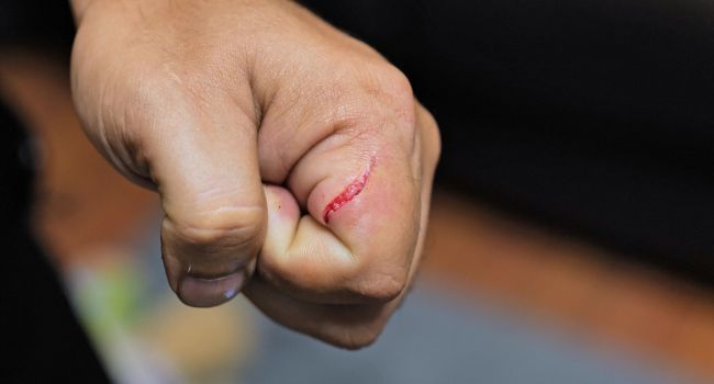 Cutting and Scratching